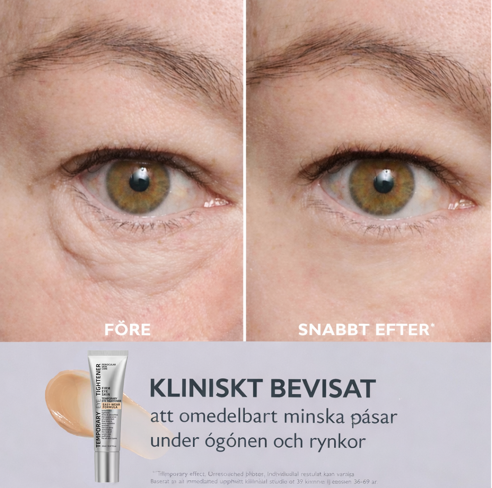 Norvella EyeLift Pro