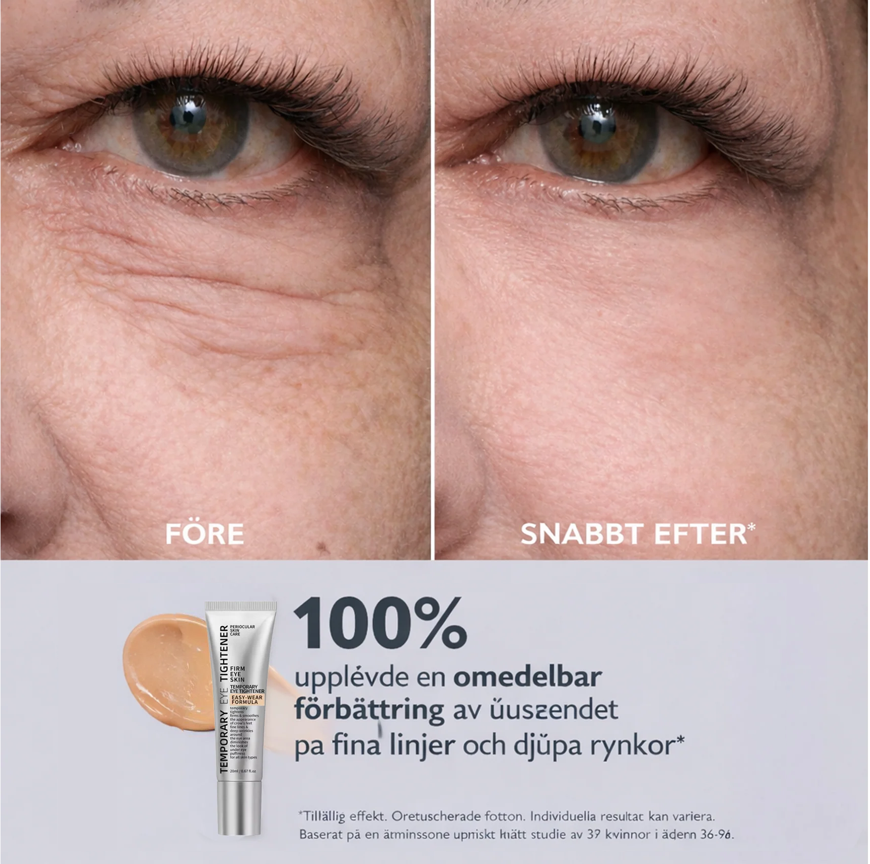 Norvella EyeLift Pro